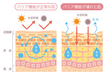 乾燥による痒み